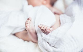 baby feet birth defects