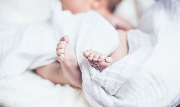 baby feet birth defects