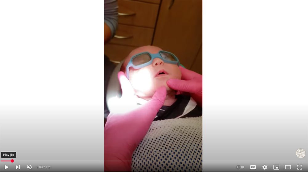 Frenotomy with soft tissue lazer - posterior tongue tie - Video