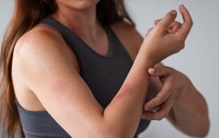 itchy while pregnant