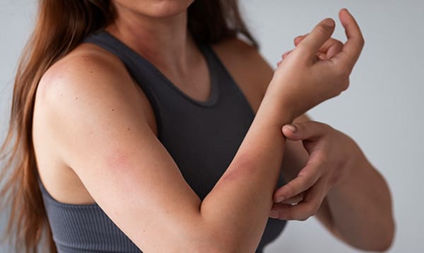 itchy while pregnant