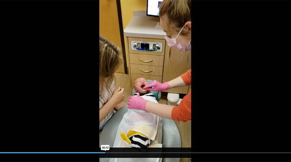 Post Frenotomy Exercises - Video