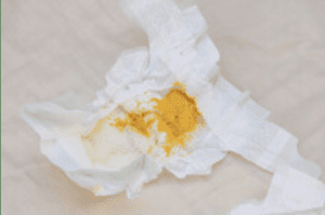 Breast milk poo in a diaper